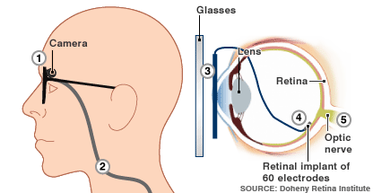 bionic_eye.gif